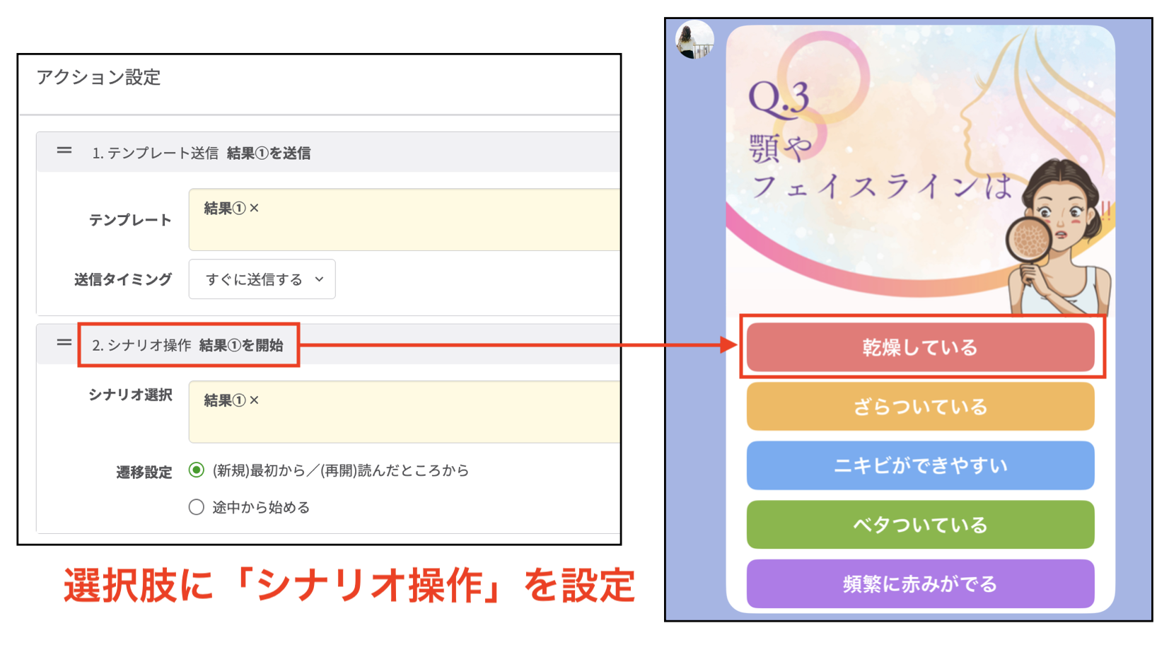 診断コンテンツを配信