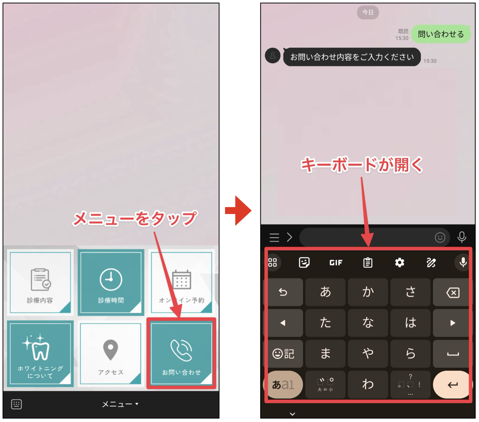 Lステップ リッチメニューお問い合わせメッセージのボタン