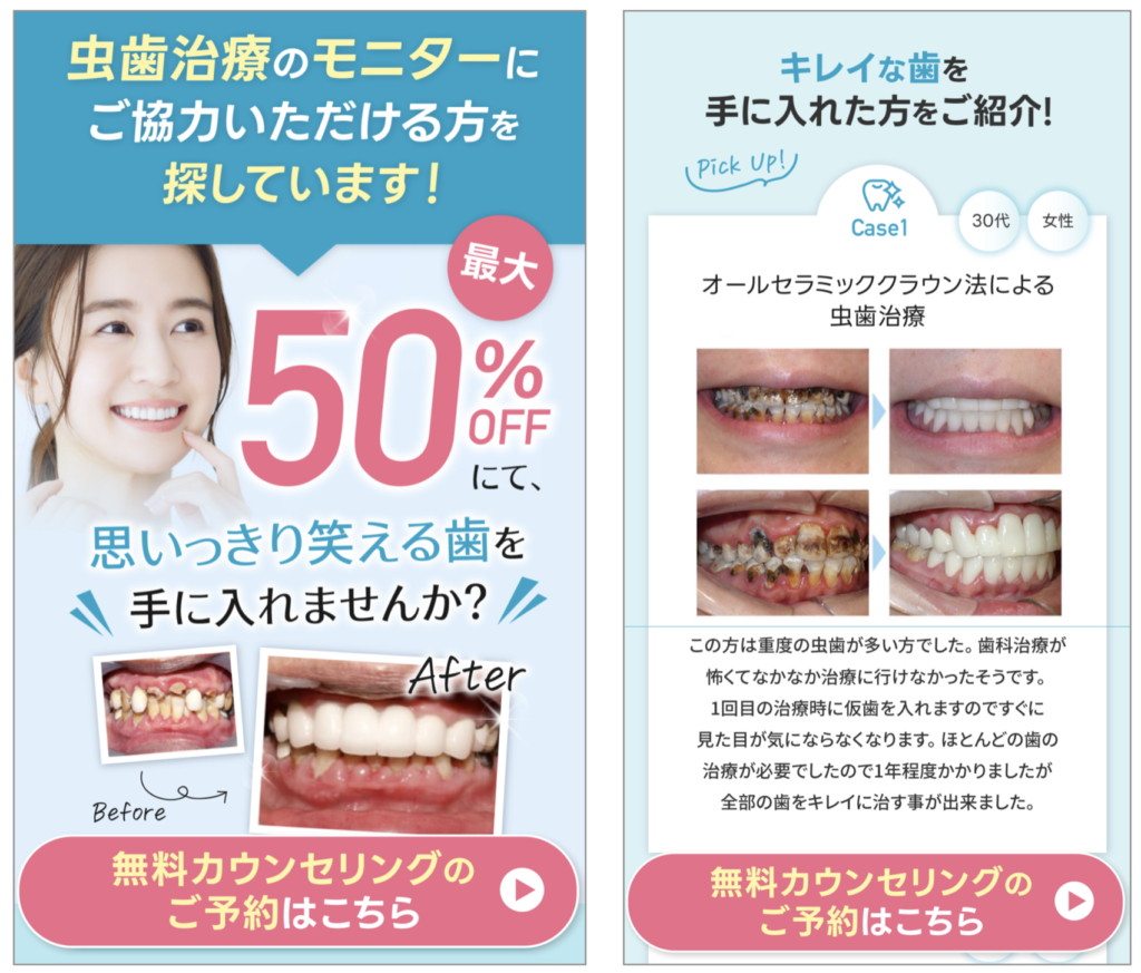 LP風のアンケートフォーム