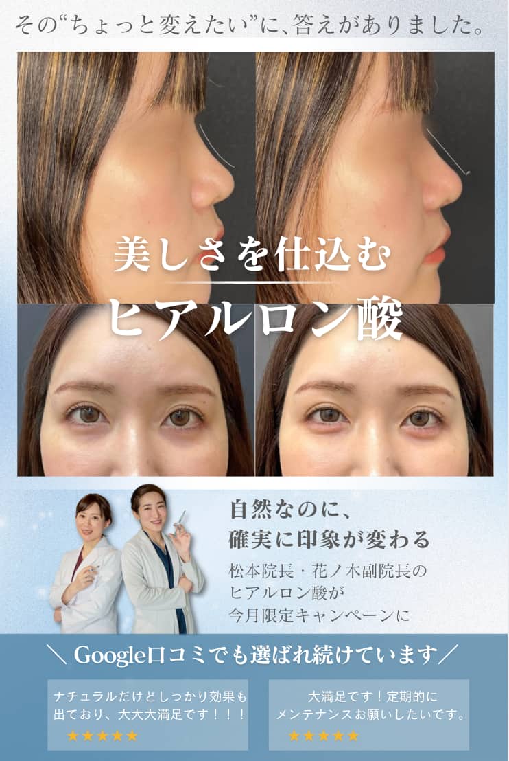 配信例